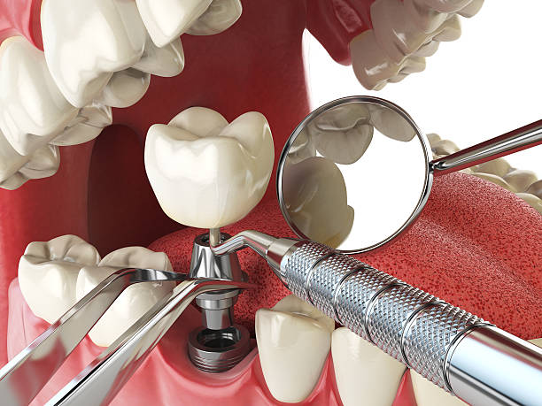 Best Emergency Treatment for Oral Infections in Surprise, AZ