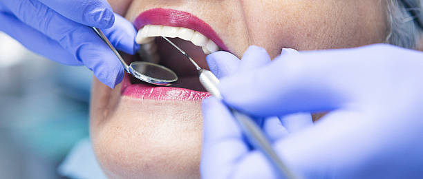 Best Knocked-Out Tooth (Avulsed Tooth) Treatment in Surprise, AZ